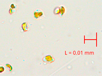 ケトセロスカルシトランスエキスの顕微鏡像（スケールバーは10μm）